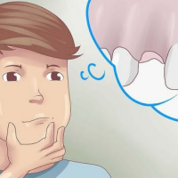 Mơ thấy gãy răng đánh con gì trúng ? điềm báo gì ? 1 mơ thấy gãy răng 1