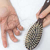 mơ thấy rụng tóc 1