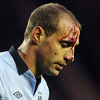 mơ thấy cá chép 10